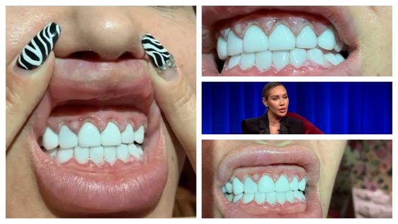 A vrut să aibă cea mai frumoasă dantură, dar a fost nevoită să treacă prin 5 operații pentru a repara întreaga situație! Raluca Podea, mai sinceră ca niciodată despre acest subiect sensibil