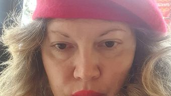 Înainte de încheierea anului 2025, Oana Lis a fost nevoită să facă o noua vizită la spital! Cum s-a postat soția lui Viorel Lis, pe rețelele de socializare?