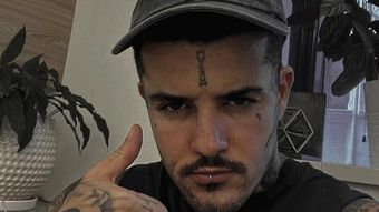 Zannidache, bandajat, pe patul de spital. Prin ce operație a trecut și cum s-a afișat tânărul