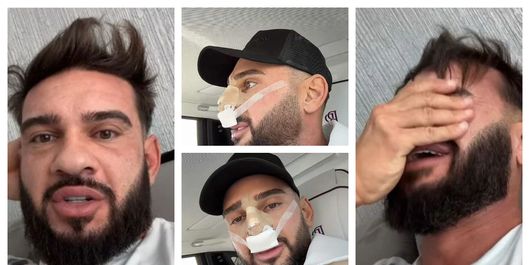 Dorian Popa, o nouă operație la nas. Ce au descoperit medicii în timpul intervenției și ce avea să complice lucrurile: „Îmi lipsea un os.”