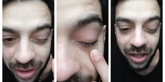 FOTO Cu ce problemă s-a trezit David Pușcaș? Fiul adoptiv al Luminiței Anghel s-a speriat și s-a dus direct cu gândul la o boală! 