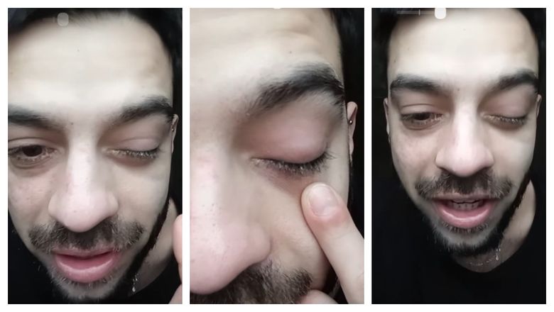 FOTO Cu ce problemă s-a trezit David Pușcaș? Fiul adoptiv al Luminiței Anghel s-a speriat și s-a dus direct cu gândul la o boală! 