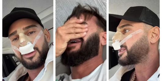 FOTO Dorian Popa și-a dat bandajul jos, la 12 zile după operație. Cum arată acum nasul artistului și ce schimbări a observat: „Un nas cum nici nu am visat.”