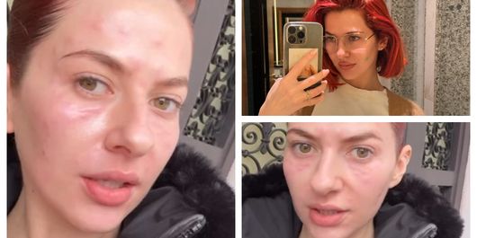 Lidia Buble răspunde comentariilor urâte, după ce a fost criticată pentru faptul că s-a afișat nemachiată: “Eu nu sunt aici ca să arăt corect. Sunt aici ca să fiu reală.”