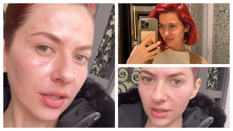 VIDEO Laura Andreșan, destăinuiri cumplite, după ce copilăria ei a fost marcată de un abuz întins pe câțiva ani: „Ajungi să crezi că așa e viața, că acesta e prețul familiei.”