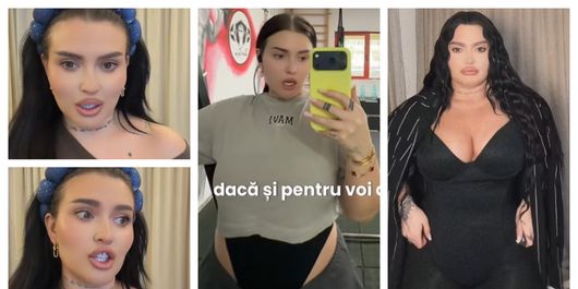 Ce spune Oana Radu despre injecțiile pentru slăbit și ce metodă are artista atunci când vine vorba de pierderea kilogramelor: “Eu slăbesc foarte repede, dar mă îngraș la fel de repede.”