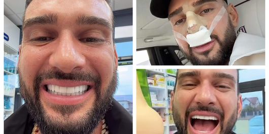 Dorian Popa mai are de așteptat până să vadă rezultatul final după operația de la nas. Cum se simte artistul în prezent: “Nu-l simt încă al meu.”