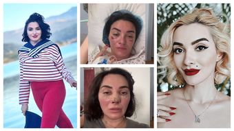 Ce operații estetice și-a făcut Ana Morodan. Cum a ajuns vedeta să cântărească 48 de kilograme: „Nu am urmat nicio dietă!”