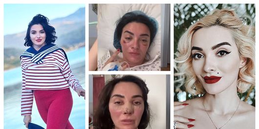 Ce operații estetice și-a făcut Ana Morodan. Cum a ajuns vedeta să cântărească 48 de kilograme: „Nu am urmat nicio dietă!”