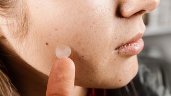 Plasturii pentru coșuri: un truc discret care îți salvează tenul înainte de un eveniment important