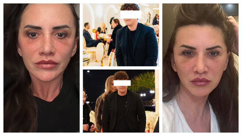 Clipe de groază pentru Mara Bănică. Fiul jurnalistei ar fi fost bătut cu picioarele de un profesor: “Sunt foarte necăjită, bulversată, șocată!” Clipe de groază pentru Mara Bănică. Fiul jurnalistei ar fi fost bătut cu picioarele de un profesor: “Sunt foarte necăjită, bulversată, șocată!”