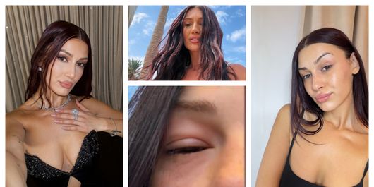 Alina Eremia, apariție îngrijorătoare pe rețelele de socializare. Ce a pățit artista și de ce a ajuns la perfuzii: “Aveți grijă de voi!”