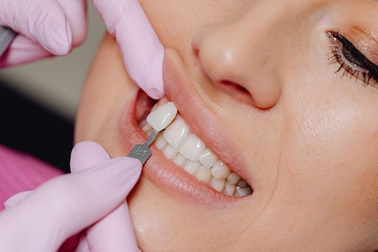 (P) Estetica Dentară Minim Invazivă: Echilibrul Perfect Între Conservarea Dintelui și Investiția Financiară