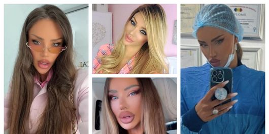 Bianca Drăgușanu, pregătită pentru a treia rinoplastie. Cu ce probleme s-a confruntat vedeta până acum: „A încercat să repare.”