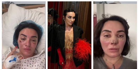 Ana Morodan ar putea avea nevoie de un rinichi? Ce declarații a făcut vedeta chiar pentru fanii ei: “Să vă văd atunci!”