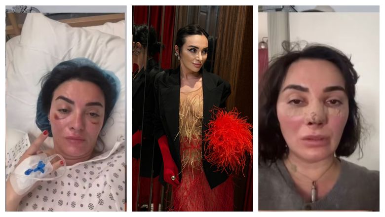 Ana Morodan ar putea avea nevoie de un rinichi? Ce declarații a făcut vedeta chiar pentru fanii ei: “Să vă văd atunci!”