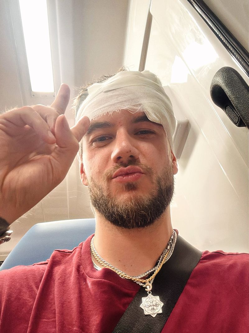 Theo Zeciu accidentat