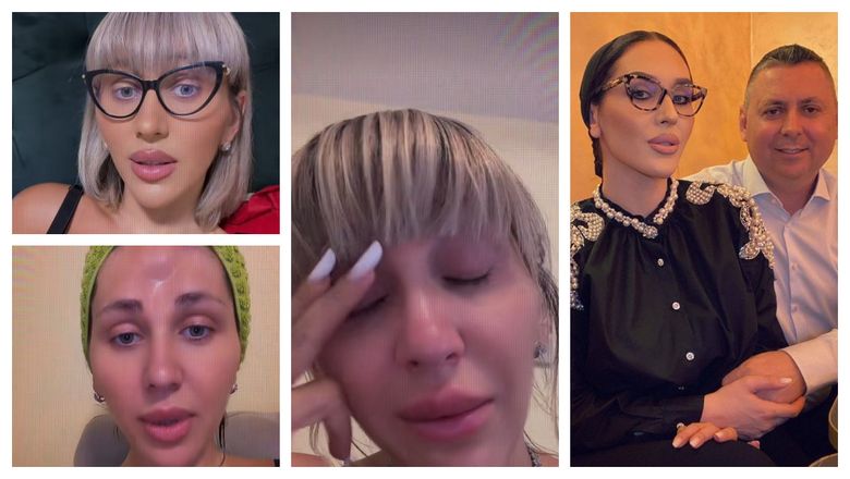 Scapa de cosuri pentru totdeauna cu aceste tratamente naturale! Uite cum!