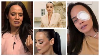 Andreea Raicu, apariție îngrijorătoare cu ochiul bandajat. Vedeta a povestit ce i s-a întâmplat: “Este îngrozitor.”