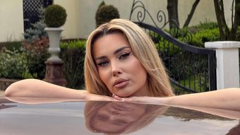 Oana Monea a spus adevărul despre schimbarea de look! Ce intervenții estetice și-a făcut, de fapt: „Știam că gurile rele vor avea ceva de comentat!”