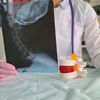 (P) Osteofitoza: ce este, de ce apare și cum se tratează?