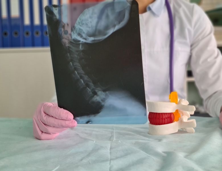 (P) Osteofitoza: ce este, de ce apare și cum se tratează?