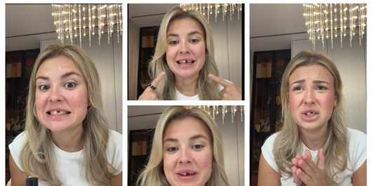 Influencerița Lorena Popa, un an fără un dinte din față. Ce s-a întâmplat și când va putea să zâmbească larg din nou: “Mă uit la mine așa pentru ultima dată.”