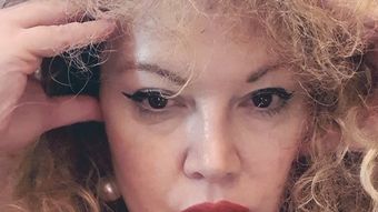 Ce se întâmplă cu Viorel Lis în aceste momente. Oana Lis vorbește despre problemele de sănătate cu care se confruntă partenerul ei: “M-am speriat foarte rău, m-a afectat.”