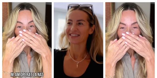 Flavia Mihășan, de nerecunoscut după operația suferită la nas: „Nu pot să cred.”