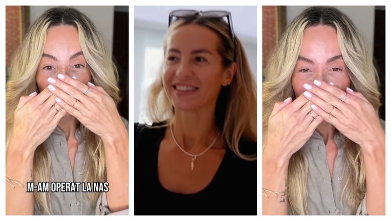Flavia Mihășan, de nerecunoscut după operația suferită la nas: „Nu pot să cred.”