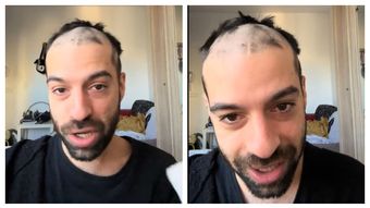 David Pușcaș, schimbare șocantă de look: „Nu mi-e rușine de ceea ce sunt.”