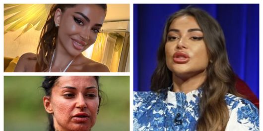 VIDEO Elena Ionescu, despre lupta cu acneea. Cât de afectată a fost artista de problemele cu tenul: “Am uitat să mă odihnesc, să am grijă de mine.”