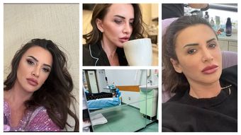 Mara Bănică și-a făcut o nouă intervenție estetică: „Da, da, eu sunt:”