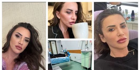 Mara Bănică și-a făcut o nouă intervenție estetică: „Da, da, eu sunt!”
