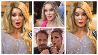 VIDEO Alina Laufer a recunoscut de ce și-a făcut ultima intervenție estetică: „Dacă sunt așa mai dărâmată din punct de vedere psihic, prefer, să spunem că asta e terapia mea.”