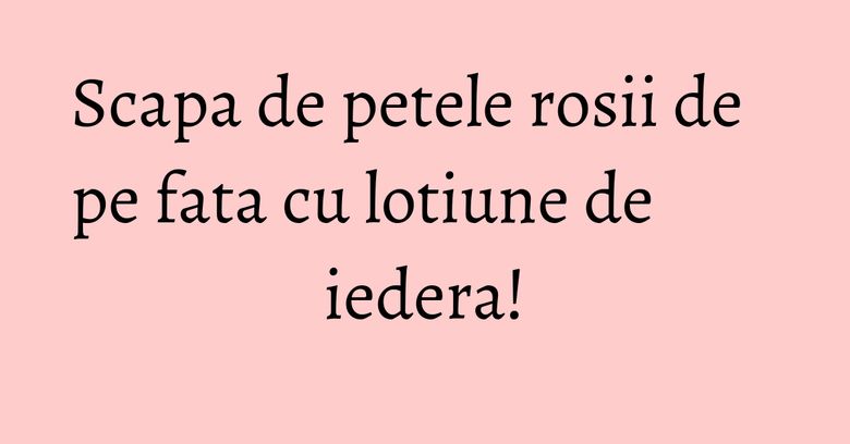 Scapa de petele rosii de pe fata cu lotiune de iedera! Scapa de petele rosii de pe fata cu lotiune de iedera!
