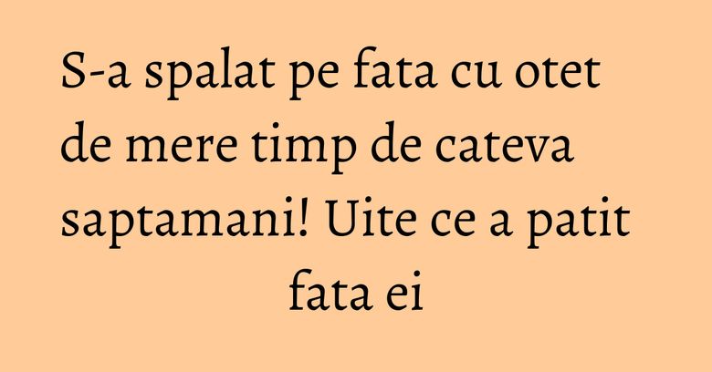 S-a spalat pe fata cu otet de mere timp de cateva saptamani! Uite ce a patit fata ei S-a spalat pe fata cu otet de mere timp de cateva saptamani! Uite ce a patit fata ei