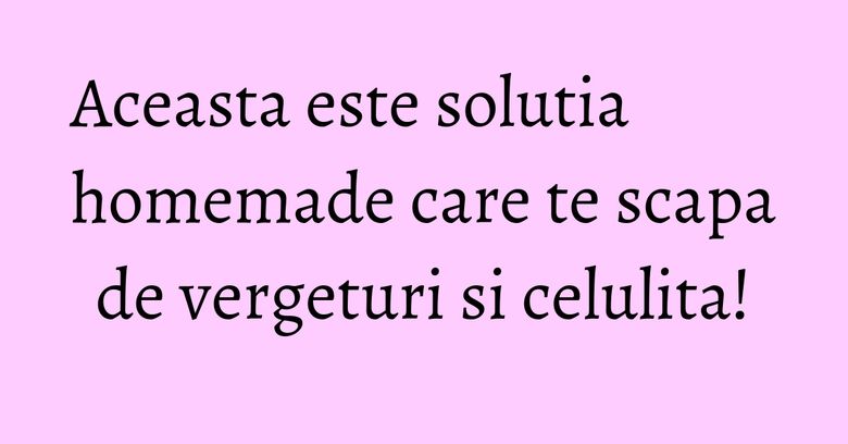Aceasta este solutia homemade care te scapa de vergeturi si celulita! Aceasta este solutia homemade care te scapa de vergeturi si celulita!