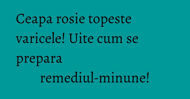 Ceapa rosie topeste varicele! Uite cum se prepara remediul-minune! Ceapa rosie topeste varicele! Uite cum se prepara remediul-minune!