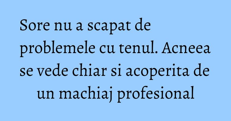 Sore nu a scapat de problemele cu tenul. Acneea se vede chiar si acoperita de un machiaj profesional Sore nu a scapat de problemele cu tenul. Acneea se vede chiar si acoperita de un machiaj profesional