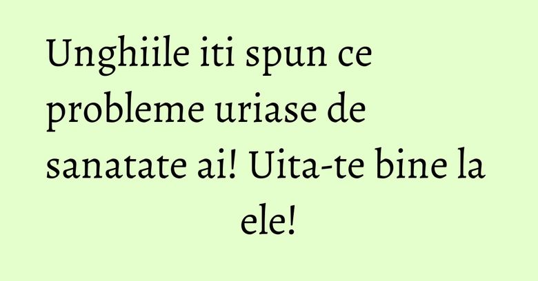 Unghiile iti spun ce probleme uriase de sanatate ai! Uita-te bine la ele!