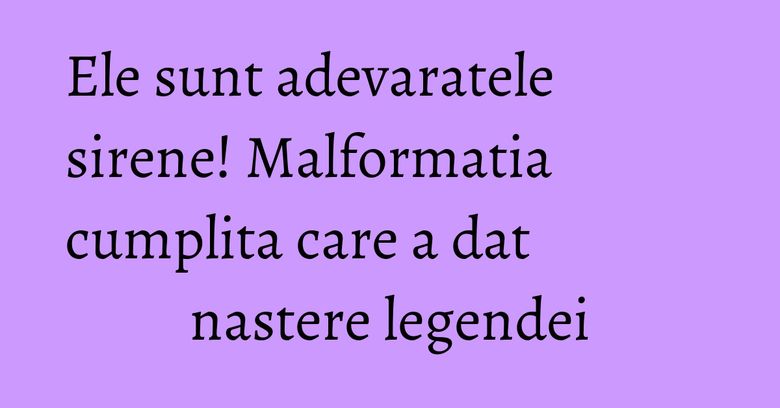 Ele sunt adevaratele sirene! Malformatia cumplita care a dat nastere legendei
