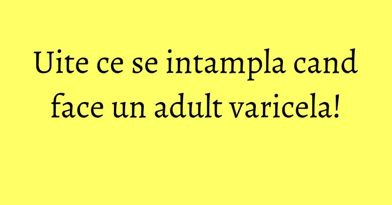 Uite ce se intampla cand face un adult varicela!