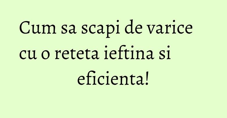 Cum sa scapi de varice cu o reteta ieftina si eficienta! Cum sa scapi de varice cu o reteta ieftina si eficienta!