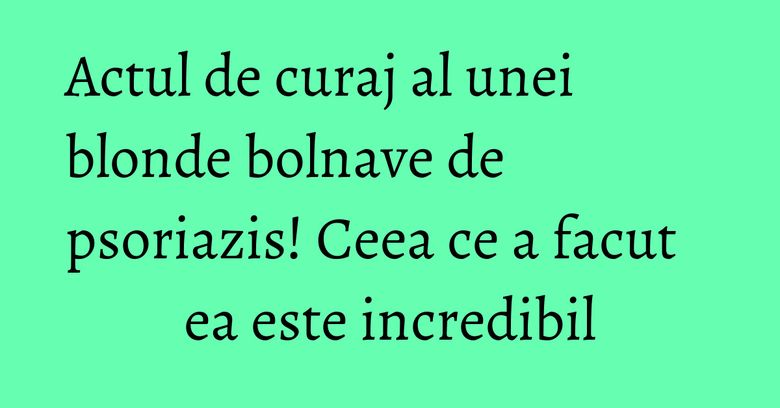 Actul de curaj al unei blonde bolnave de psoriazis! Ceea ce a facut ea este incredibil Actul de curaj al unei blonde bolnave de psoriazis! Ceea ce a facut ea este incredibil