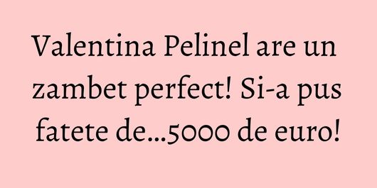 Valentina Pelinel are un zambet perfect! Si-a pus fatete de…5000 de euro!