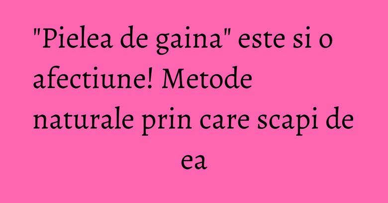 "Pielea de gaina" este si o afectiune! Metode naturale prin care scapi de ea "Pielea de gaina" este si o afectiune! Metode naturale prin care scapi de ea