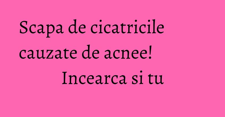 Scapa de cicatricile cauzate de acnee! Incearca si tu