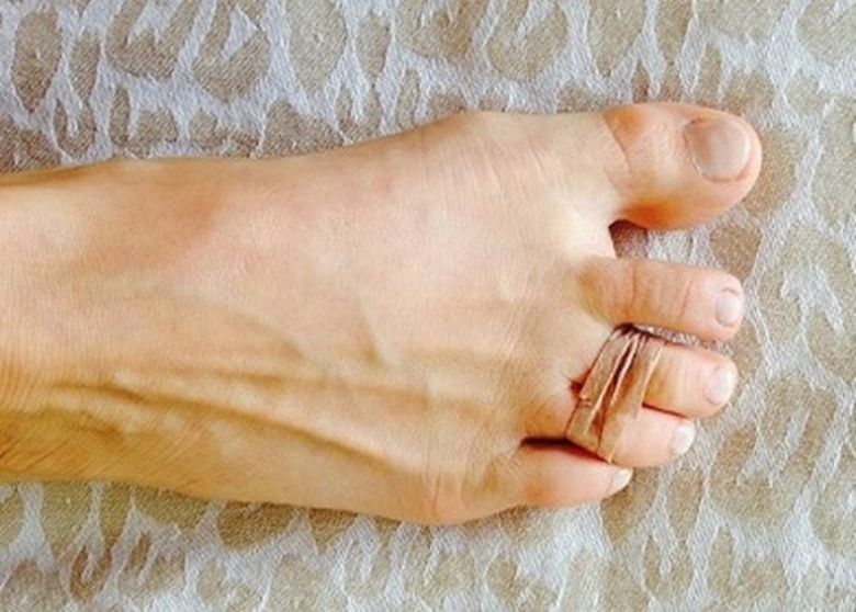 Asa scapi de durerile provocate de pantofii cu toc, dupa Revelion