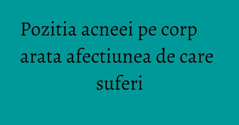 Pozitia acneei pe corp arata afectiunea de care suferi Pozitia acneei pe corp arata afectiunea de care suferi